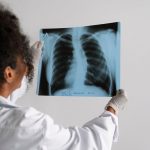 Darurat Tuberkulosis: 1 Juta Kasus Baru Tiap Tahun, Ini Solusinya?