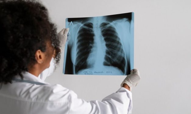 Darurat Tuberkulosis: 1 Juta Kasus Baru Tiap Tahun, Ini Solusinya?