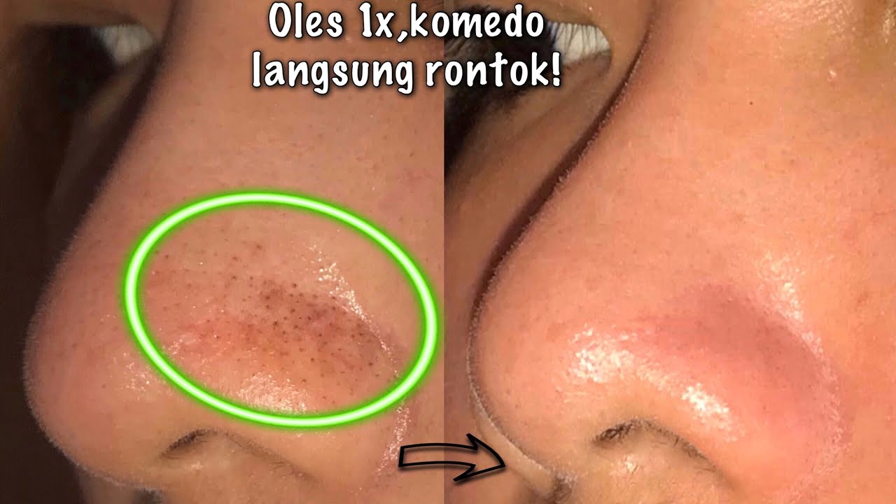 Rahasia