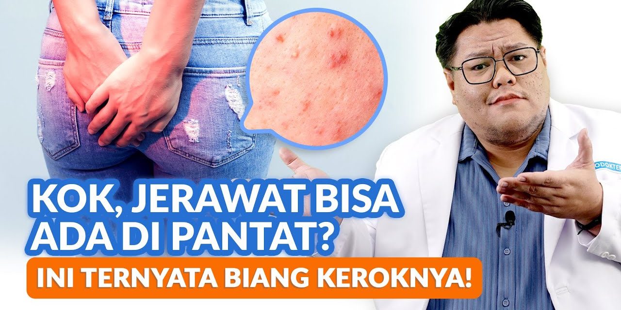 Jerawat Di Bokong, Inilah Penyebab Dan Cara Pengobatannya