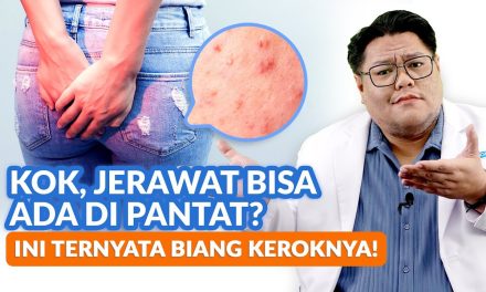 Jerawat Di Bokong, Inilah Penyebab Dan Cara Pengobatannya