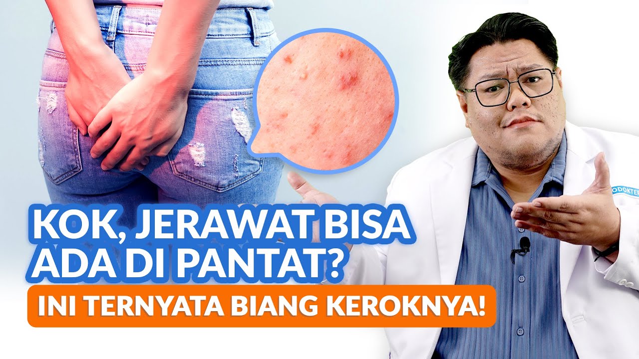 Jerawat